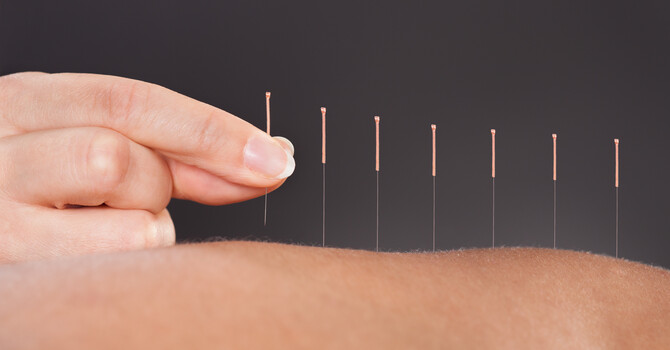 Registered Acupuncture