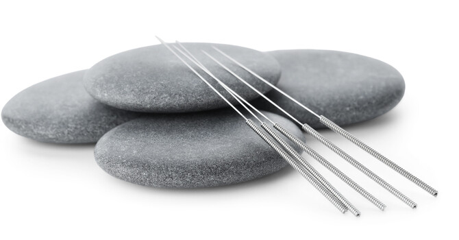 Community Acupuncture